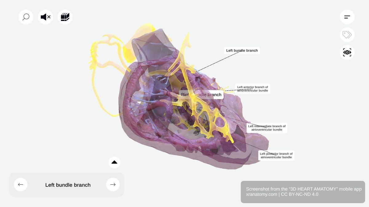 Right bundle branch 360-degree viewer showing conduction pathway along right side of interventricular septum toward right ventricle and moderator band