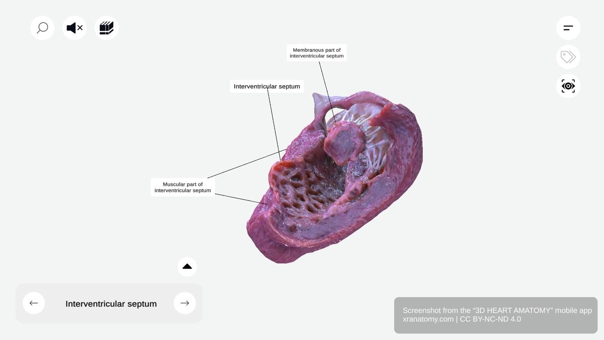 Interventricular septum 360-degree viewer showing robust muscular wall dividing left and right ventricles with muscular and membranous parts