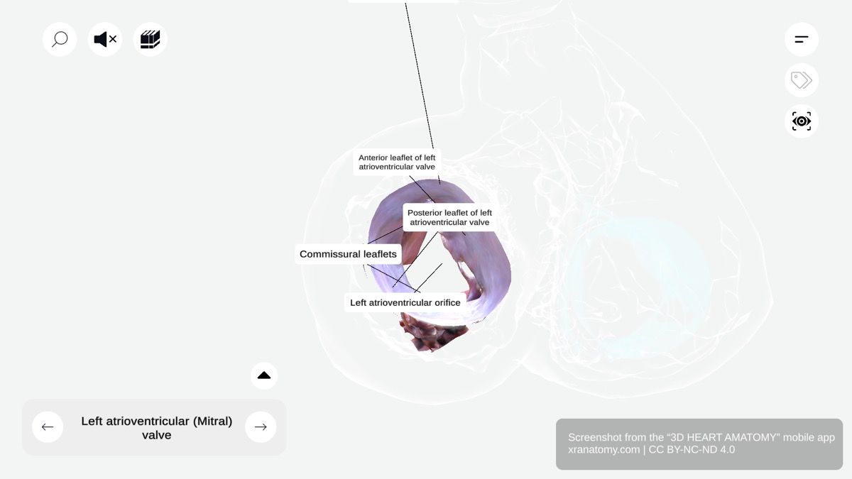 Left atrioventricular orifice 360-degree interactive viewer showing opening between left atrium and ventricle