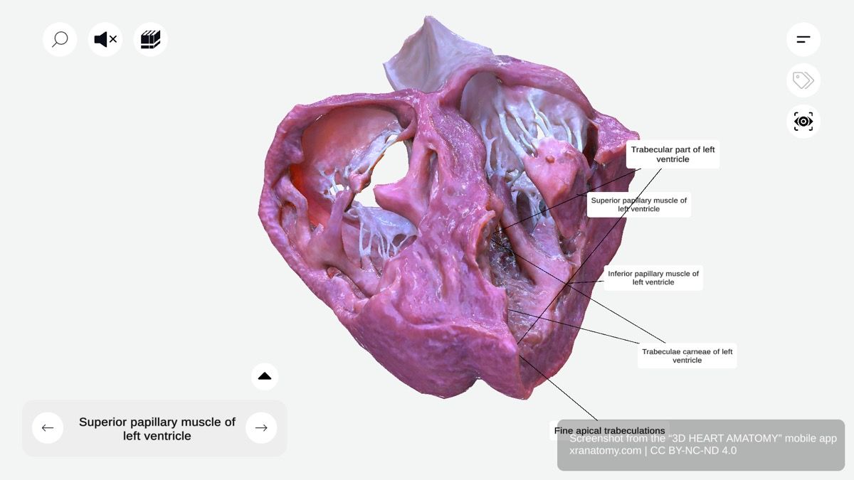 Tension apparatus 360-degree interactive viewer showing papillary muscles and chordae tendineae