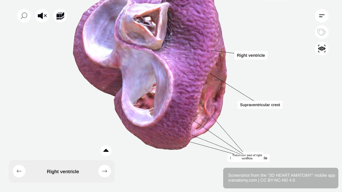Trabecular part of right ventricle 360-degree interactive viewer showing trabeculae carneae muscular ridges