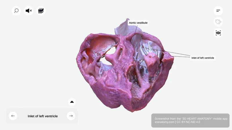 Inlet of left ventricle 360-degree interactive viewer showing region where blood enters from left atrium