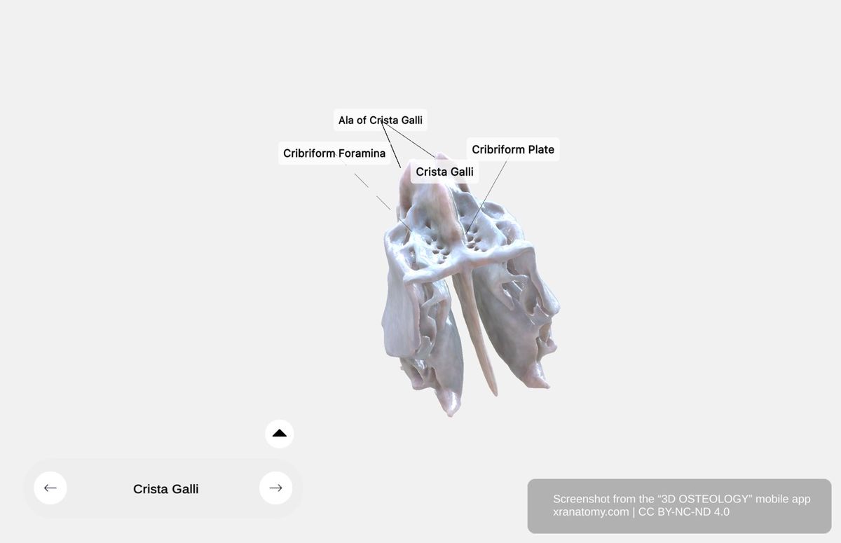 Cribriform plate 360-degree viewer showing crista galli, cribriform foramina, ala of crista galli, and ethmoidal notch of frontal bone