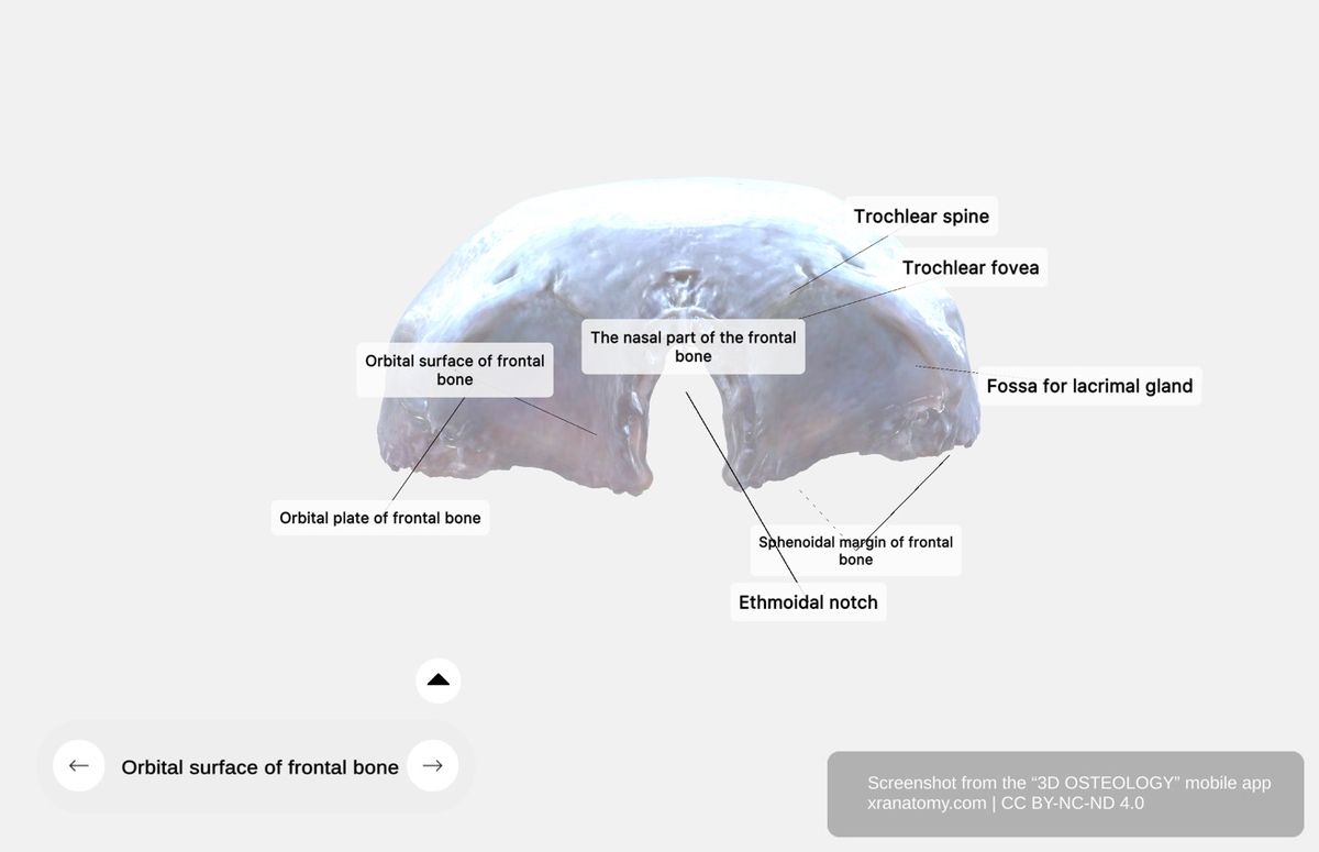 Orbital part of frontal bone 360-degree viewer showing orbital plates, ethmoidal notch, trochlear fovea, fossa for lacrimal gland, and sphenoidal margin