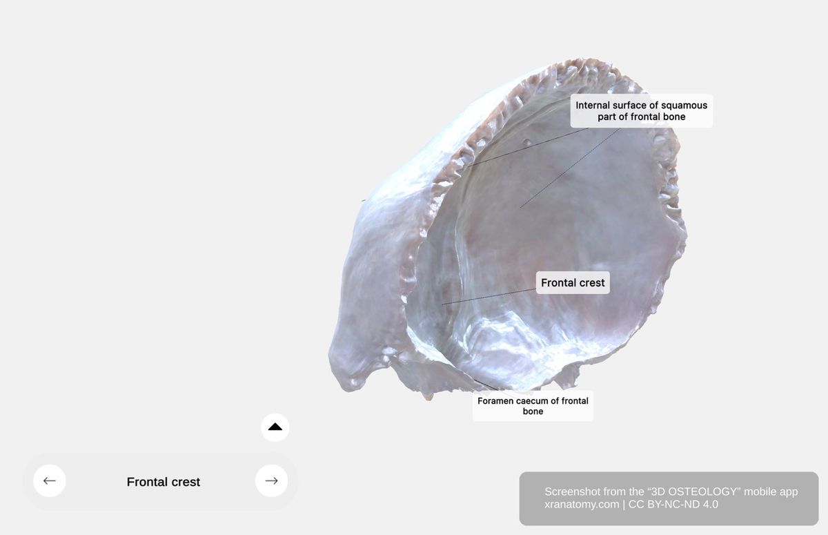 Internal surface of squamous part 360-degree viewer showing frontal crest, foramen cecum, sagittal sulcus, and cranial cavity features