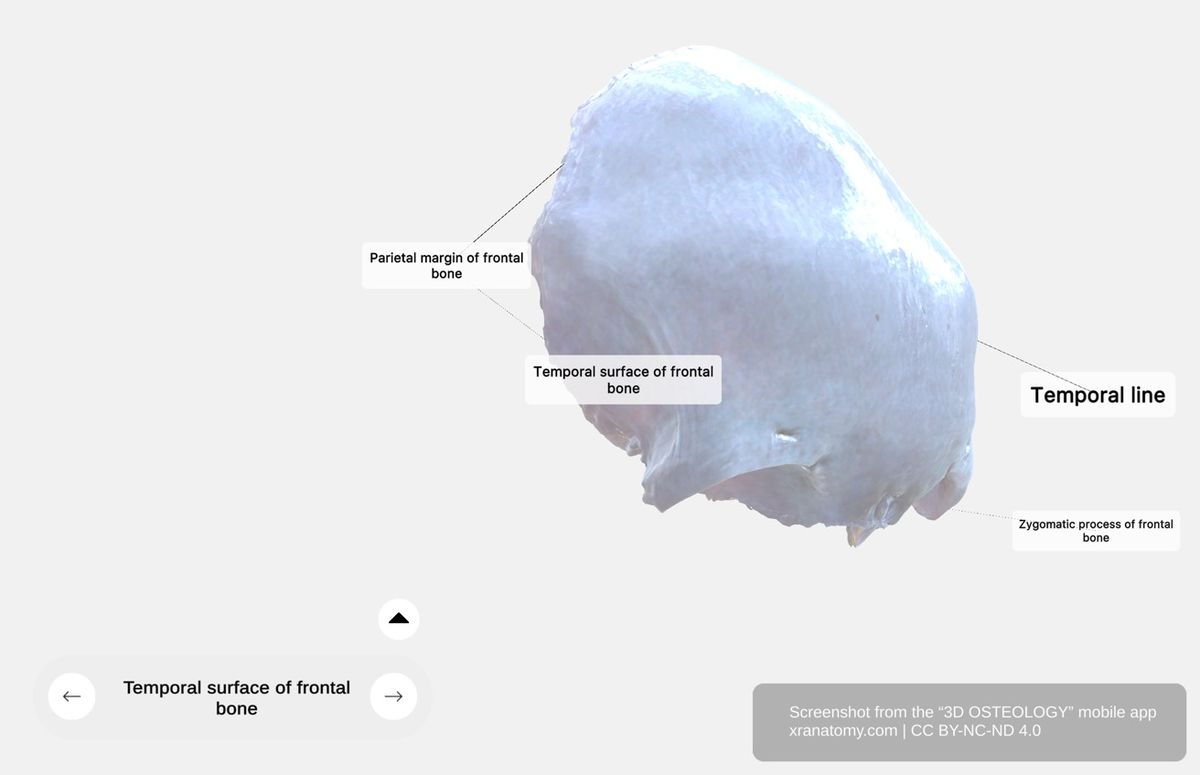 Temporal surface of frontal bone 360-degree viewer showing zygomatic process, temporal line, parietal margin, and temple region contribution