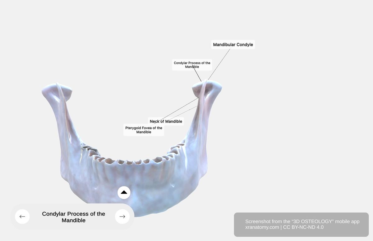 Condylar process of mandible 360-degree viewer showing mandibular condyle, neck of mandible, and pterygoid fovea for TMJ articulation