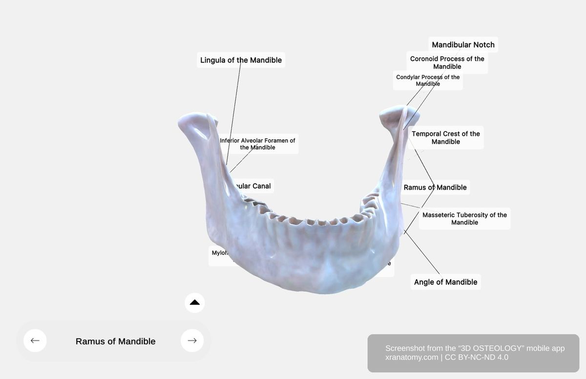 Ramus of mandible 360-degree viewer showing quadrilateral configuration, coronoid process, condylar process, mandibular notch, and angle
