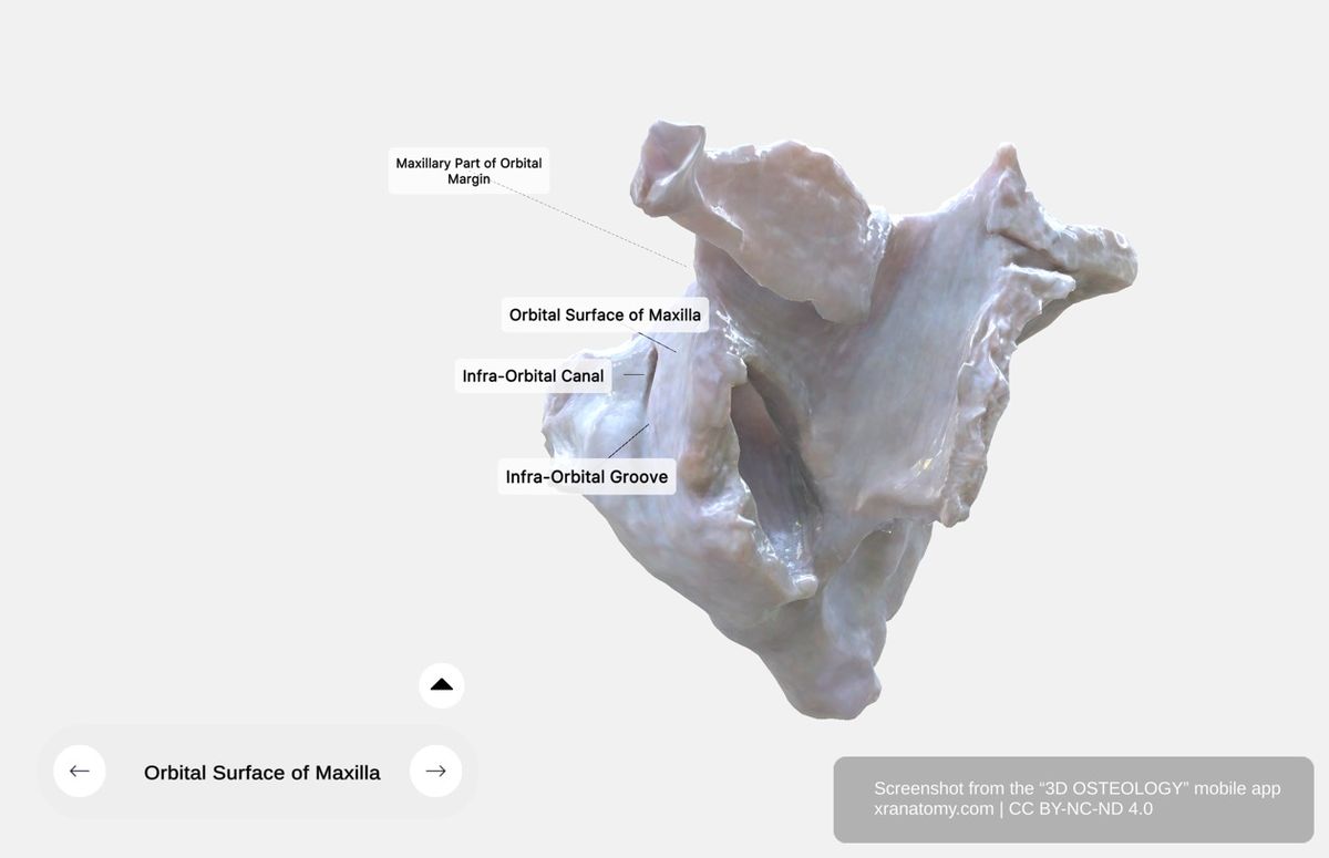 Orbital surface of maxilla 360-degree viewer showing triangular floor of orbit with infraorbital groove, infraorbital canal, and infraorbital foramen