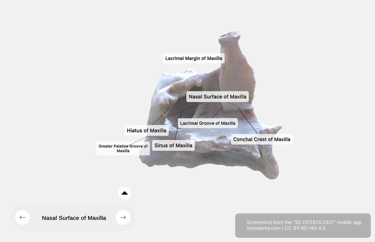 Nasal surface of maxilla 360-degree viewer showing maxillary hiatus, lacrimal groove, conchal crest, and greater palatine groove