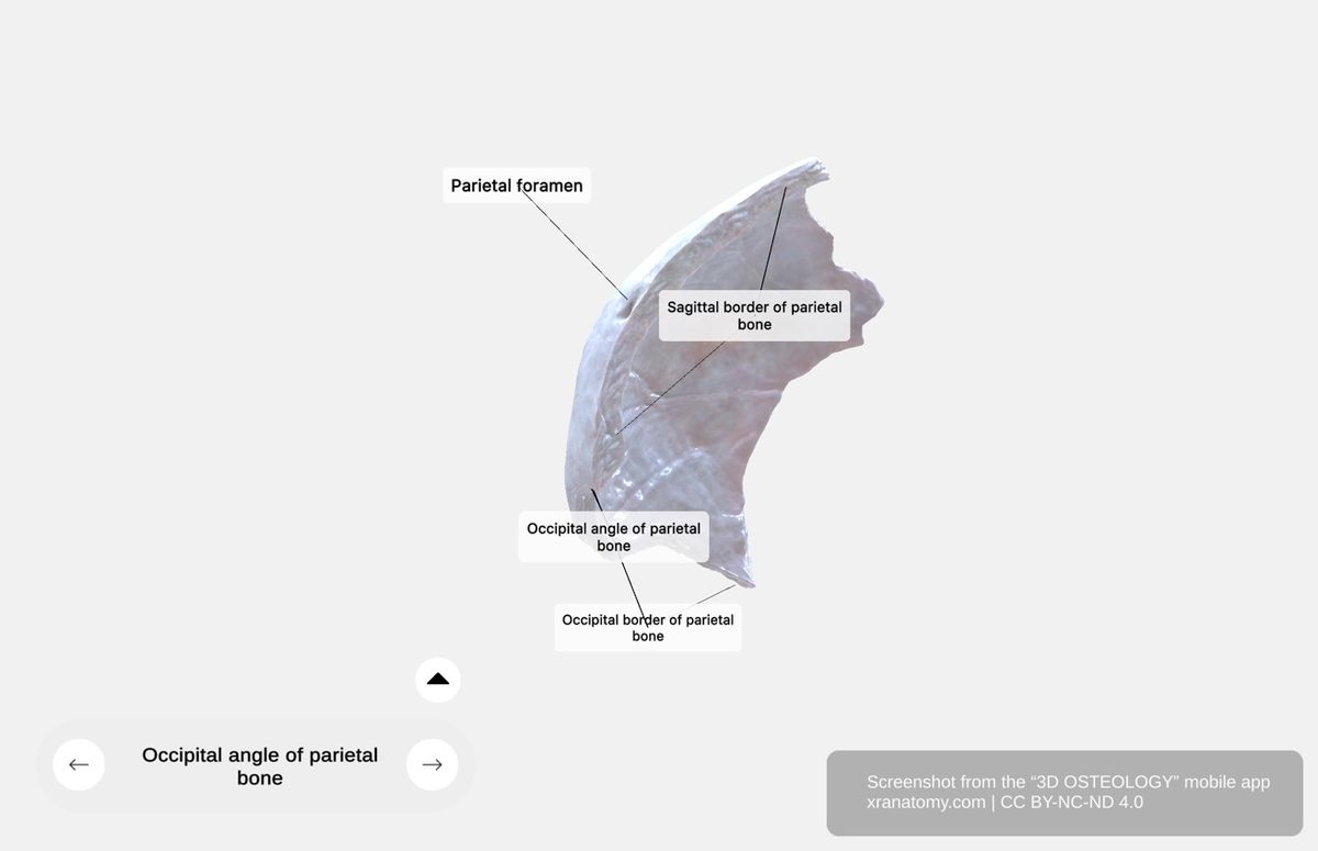 Parietal bone borders and angles 360-degree viewer showing sagittal, frontal, occipital, and squamosal borders forming cranial sutures