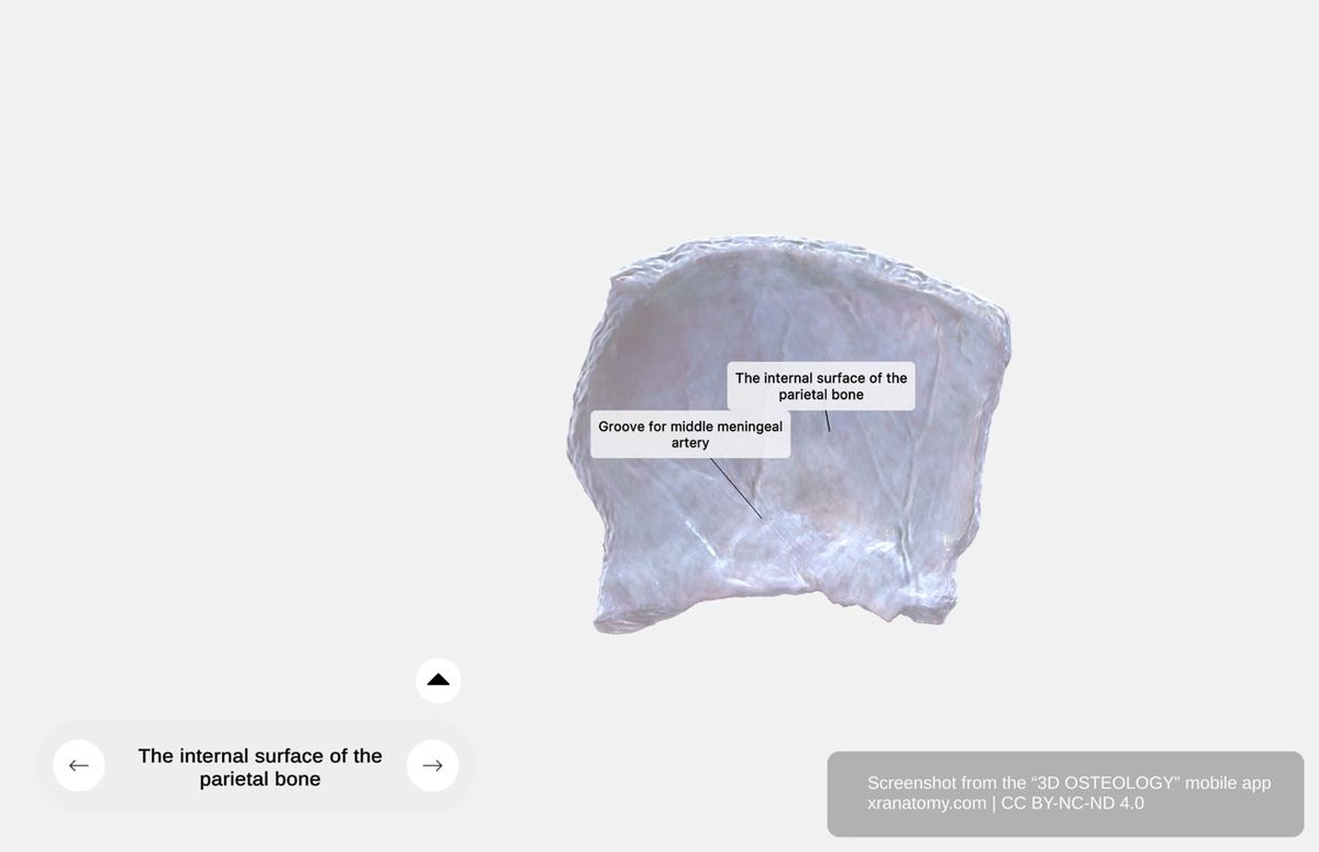 Internal surface of parietal bone 360-degree viewer showing groove for middle meningeal artery, arachnoid granulation impressions, and cerebral gyri impressions
