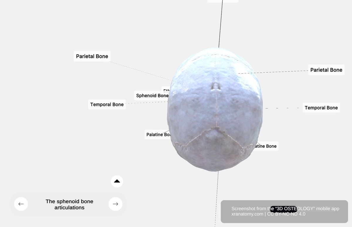 Sphenoid bone anatomy 360-degree interactive viewer showing articulations with vomer, ethmoid, frontal, occipital, parietal, temporal, zygomatic, and palatine bones