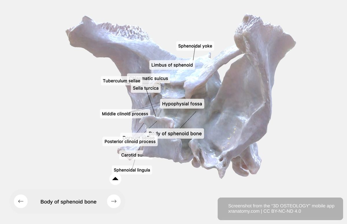 Body of sphenoid bone 360-degree viewer showing sella turcica, hypophysial fossa, dorsum sellae, carotid sulcus, sphenoidal yoke, and clinoid processes