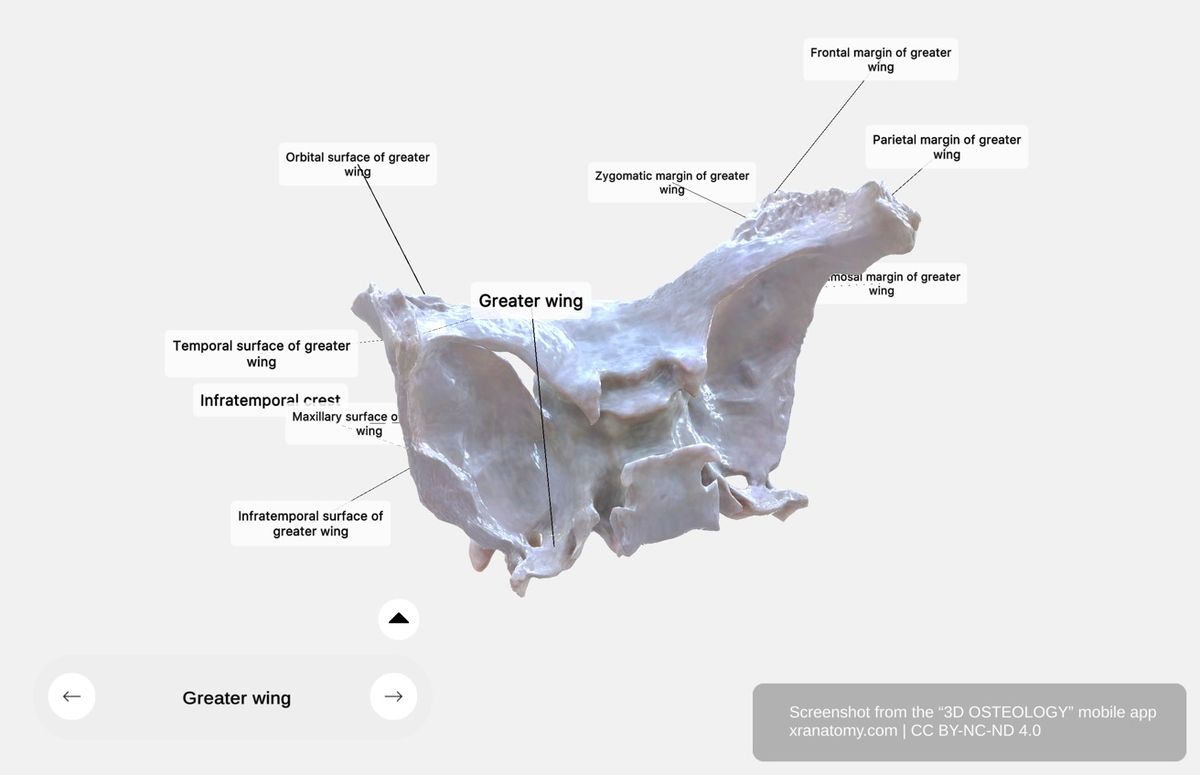 Greater wing surfaces and margins 360-degree viewer showing temporal surface, infratemporal surface, orbital surface, and articulations with zygomatic, frontal, parietal, and temporal bones