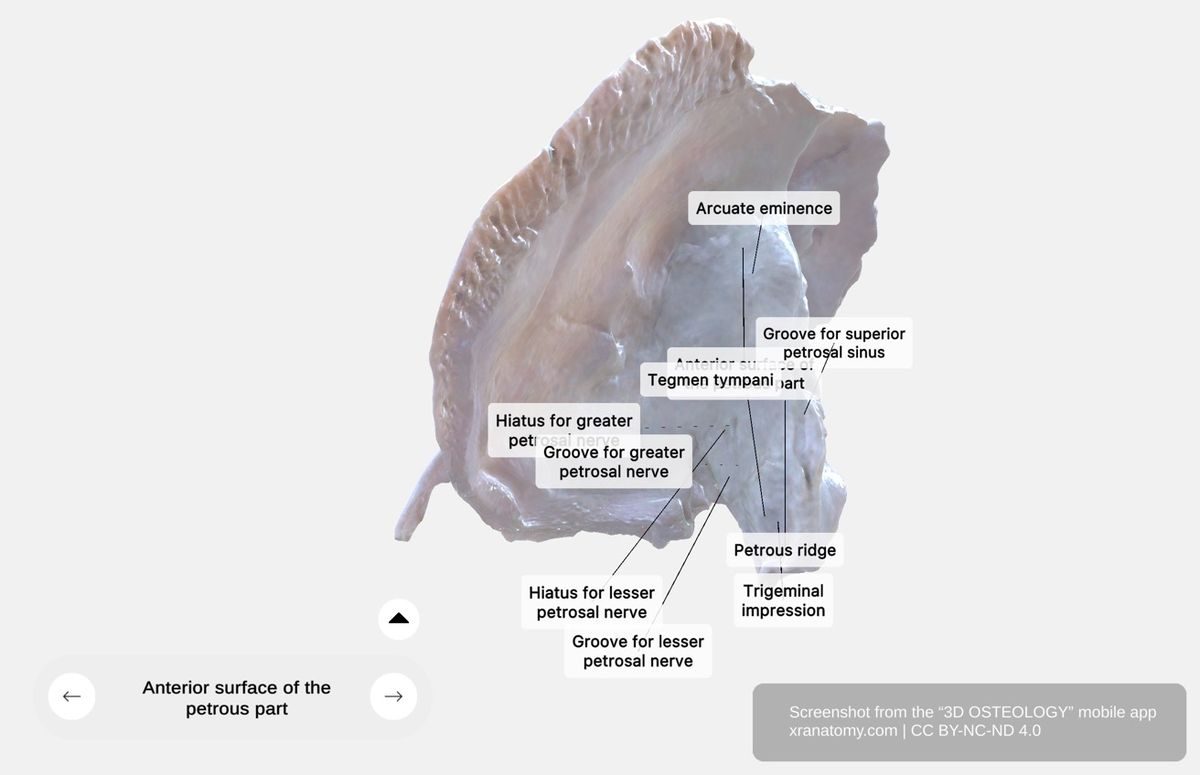 Petrous part of temporal bone anterior surface 360-degree viewer showing tegmen tympani, arcuate eminence, and trigeminal impression