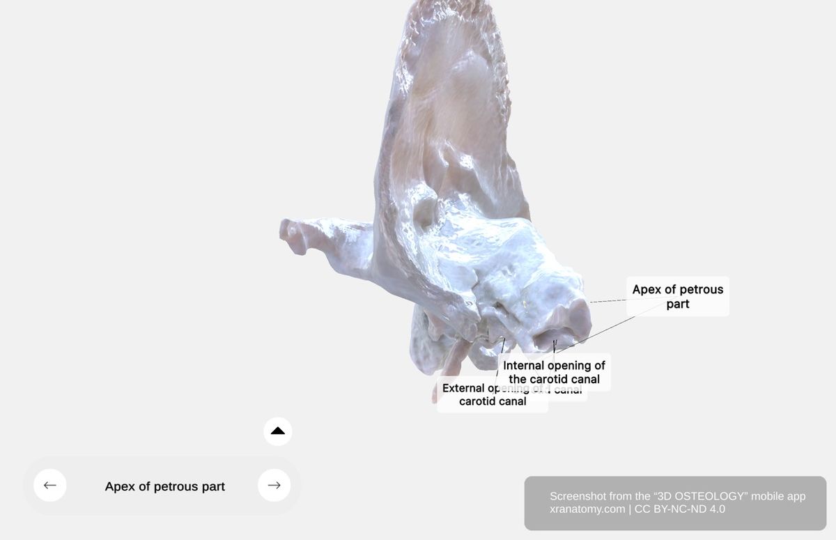Apex of petrous part 360-degree viewer showing articulation with greater wing of sphenoid and basilar portion of occipital bone