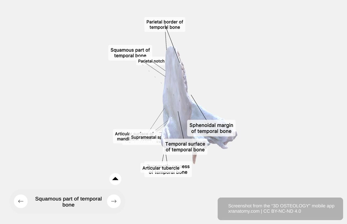 Squamous part of temporal bone 360-degree viewer showing zygomatic process, mandibular fossa, articular tubercle, and temporal surface