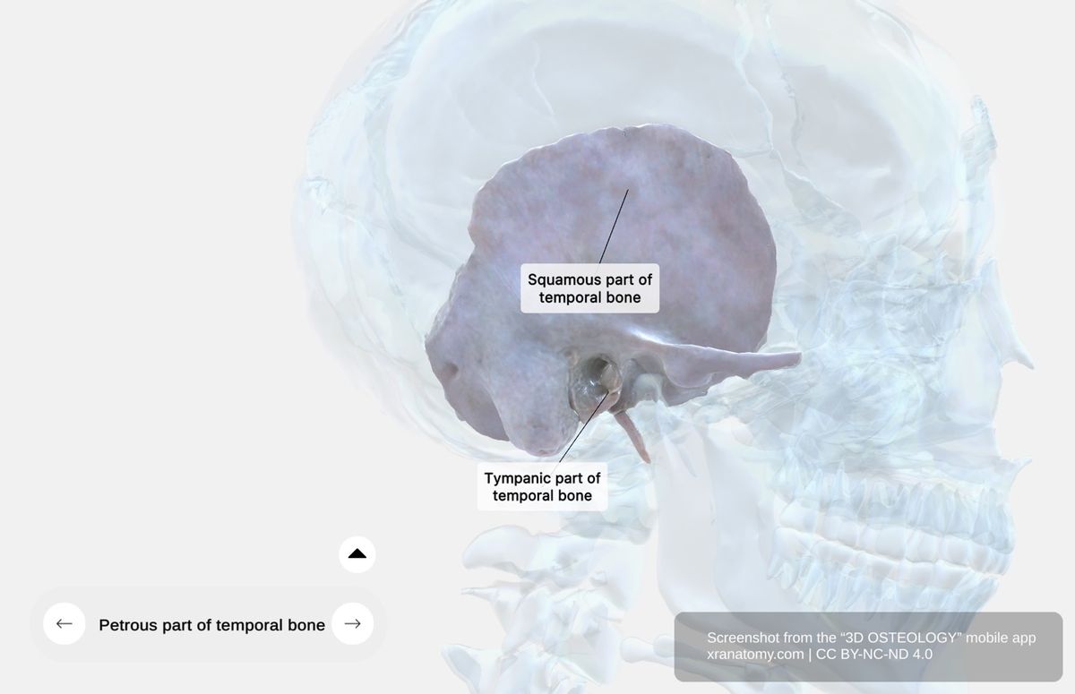 Temporal bone structural components 360-degree viewer showing squamous part, tympanic part, petrous portion, and mastoid portion