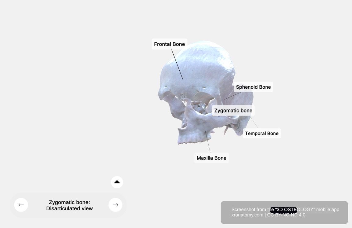 Zygomatic bone articulations 360-degree viewer showing connections with frontal bone, sphenoid bone, maxilla, and temporal bone in disarticulated view