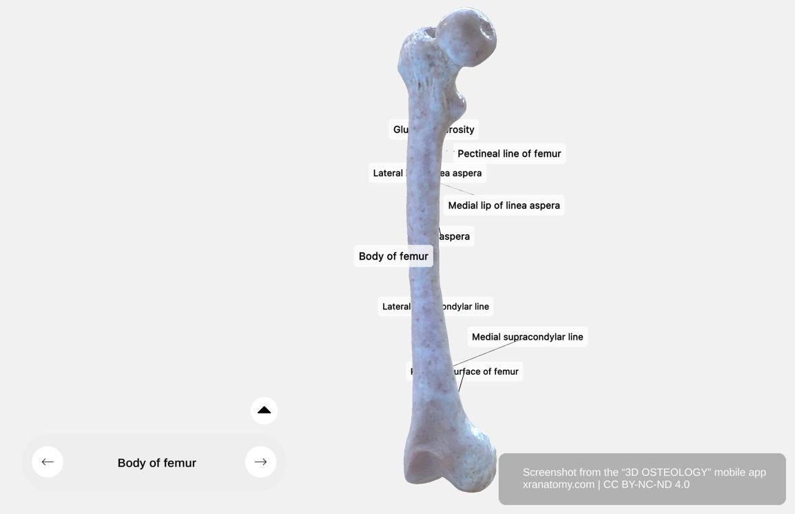 Femur body 360-degree viewer showing linea aspera with medial and lateral lips, pectineal line, gluteal tuberosity, popliteal surface, and supracondylar lines