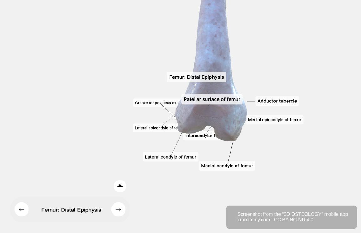 Femur distal epiphysis 360-degree viewer showing medial and lateral condyles, epicondyles, patellar surface, intercondylar fossa, and adductor tubercle