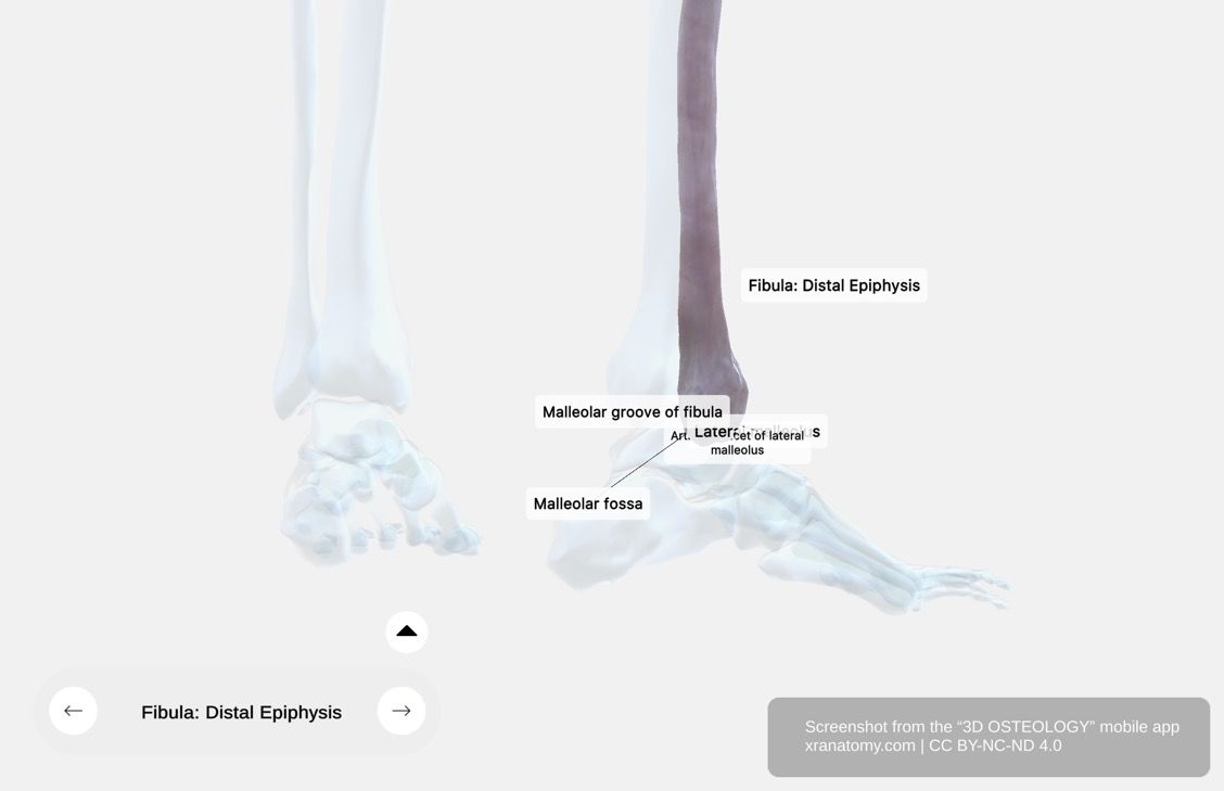 Fibula distal epiphysis 360-degree viewer showing lateral malleolus, articular facet, malleolar fossa, and malleolar groove