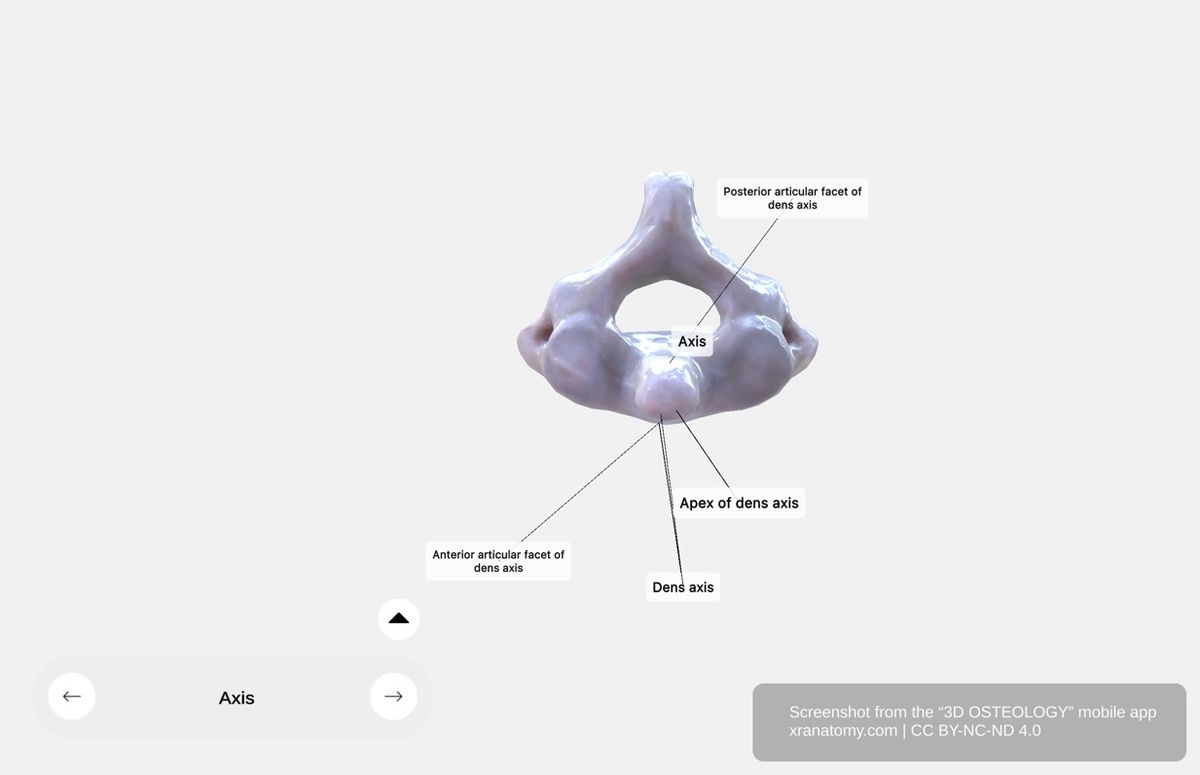 Axis articular facets 360-degree viewer showing anterior and posterior articular surfaces of the dens
