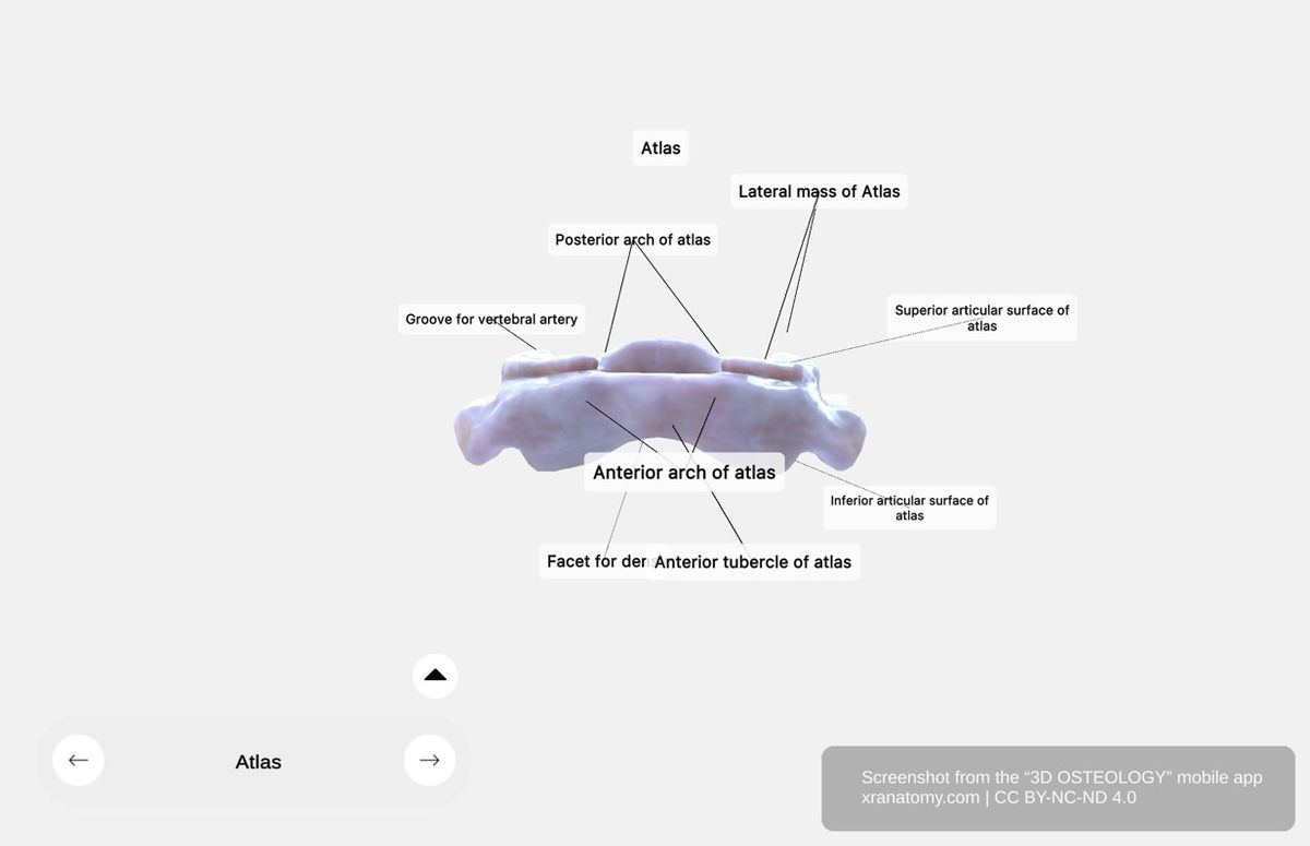 Atlas arches 360-degree viewer showing anterior arch with facet for dens and posterior arch with vertebral artery groove
