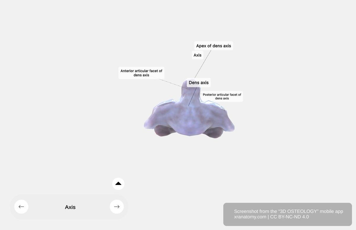 Axis dens odontoid process 360-degree viewer showing tooth-like projection, apex, and articular surfaces