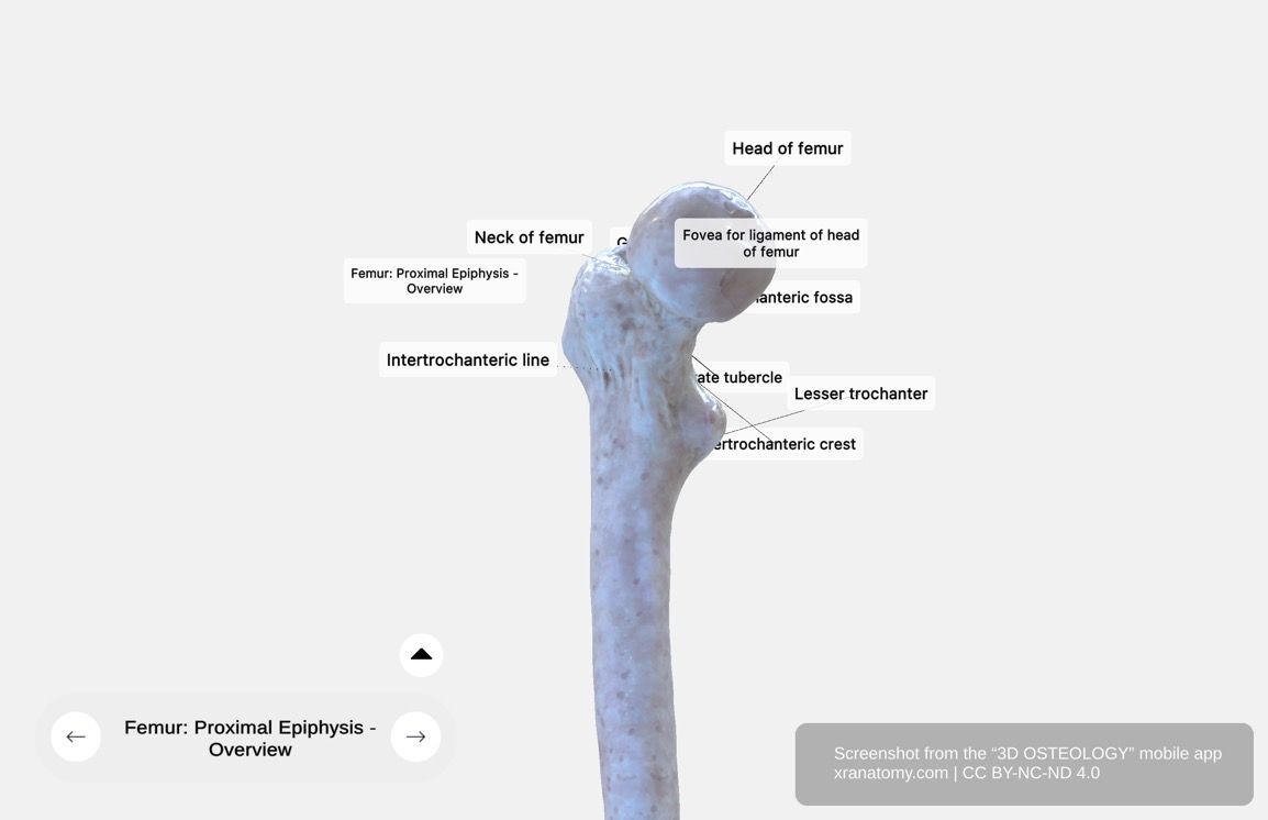Femur proximal epiphysis 360-degree viewer showing head, fovea, neck, greater trochanter, lesser trochanter, intertrochanteric line, and intertrochanteric crest