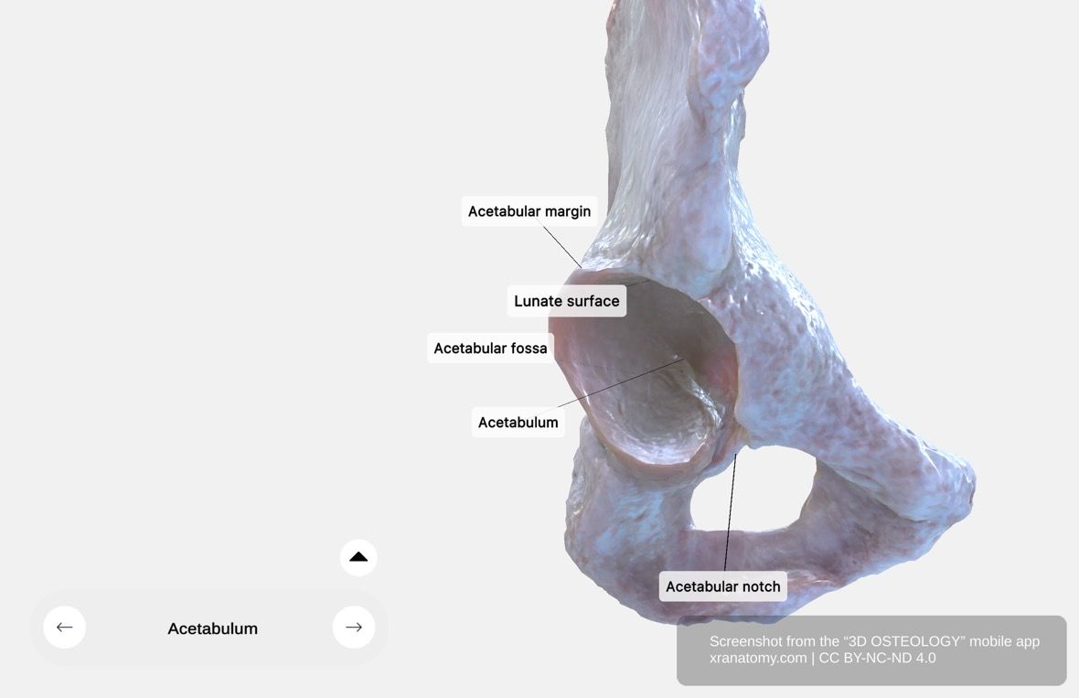 Acetabulum 360-degree viewer showing lunate surface, acetabular fossa, acetabular margin, and acetabular notch