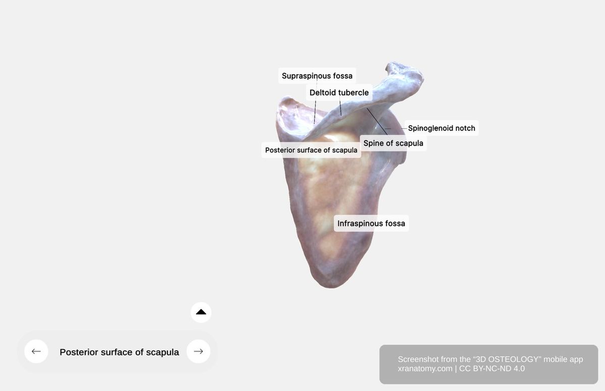 Posterior surface of scapula 360-degree viewer showing spine, supraspinous fossa, infraspinous fossa, acromion, and spinoglenoid notch