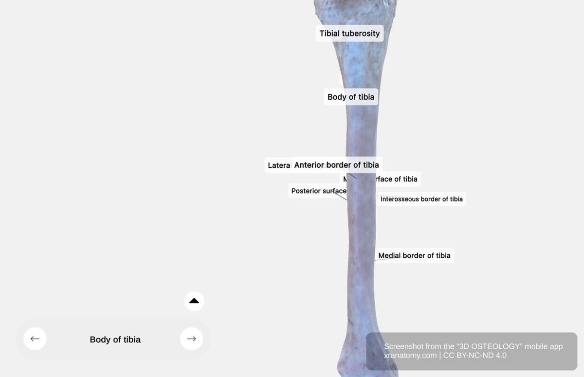 Tibia body 360-degree viewer showing tibial tuberosity, soleal line, interosseous border, anterior border, medial surface, lateral surface, and posterior surface