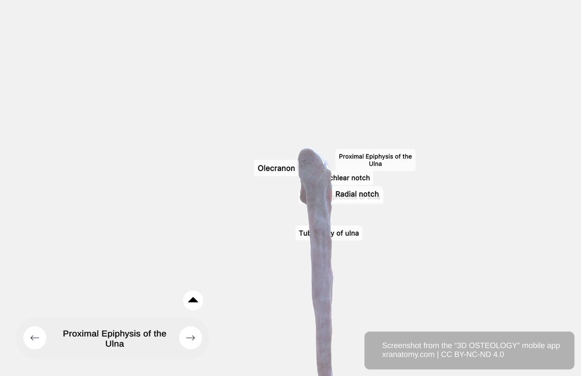 Proximal ulna 360-degree viewer showing olecranon, coronoid process, trochlear notch, radial notch, and ulnar tuberosity forming the elbow joint