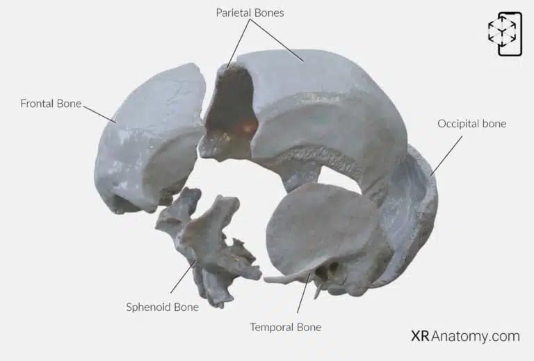 AR Figure 19 – Parietal Bone: Disarticulated view