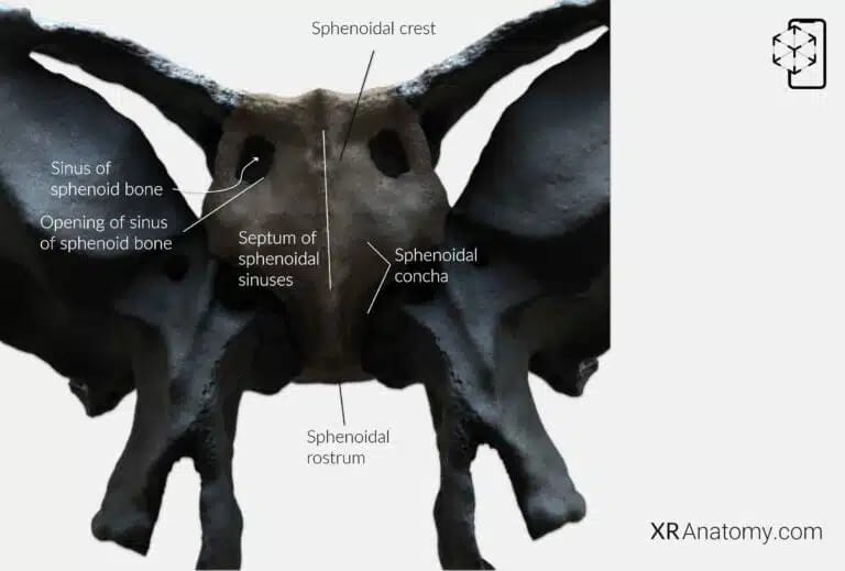 AR Figure 33 – Sphenoid Bone: Body of sphenoid bone
