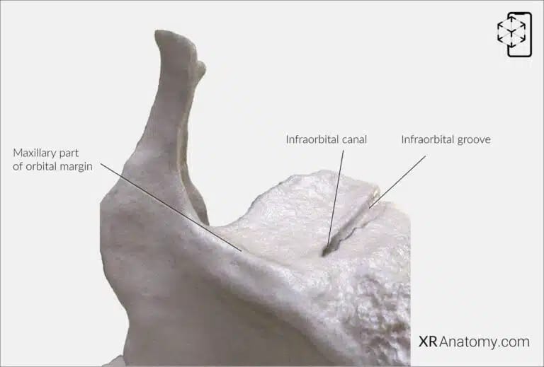 AR Figure 53 – Maxilla: Orbital surface