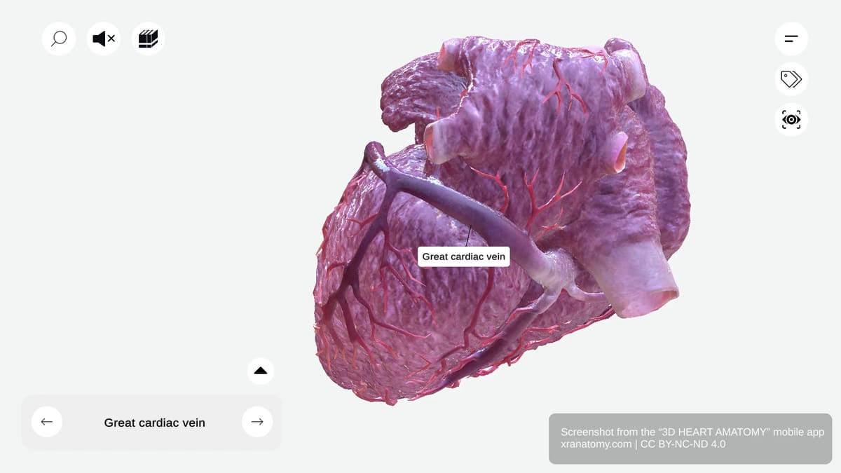 Great cardiac vein anatomy coursing in left atrioventricular groove alongside left circumflex artery