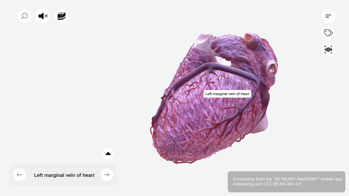 Left marginal vein anatomy draining lateral and posterior wall of left ventricle