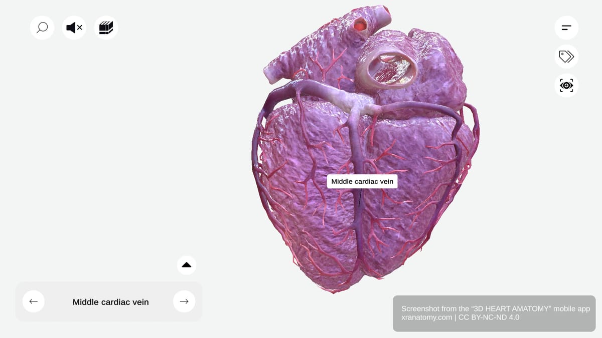Middle cardiac vein anatomy ascending with posterior interventricular artery draining into coronary sinus