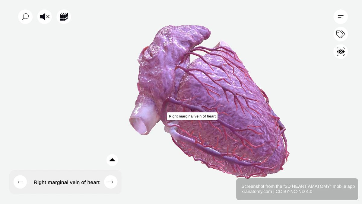 Right marginal vein anatomy following lateral wall of right ventricle