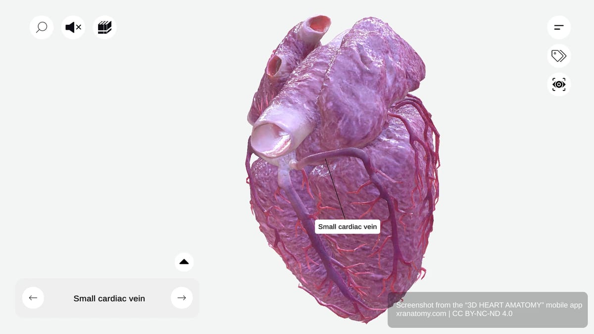 Small cardiac vein anatomy coursing alongside right coronary artery in right atrioventricular groove