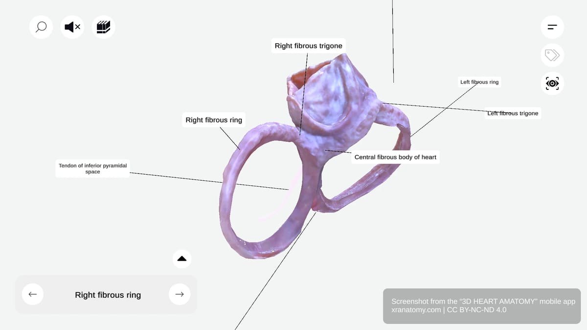 Central fibrous body of the heart showing the strongest portion of cardiac skeleton surrounded by valve rings