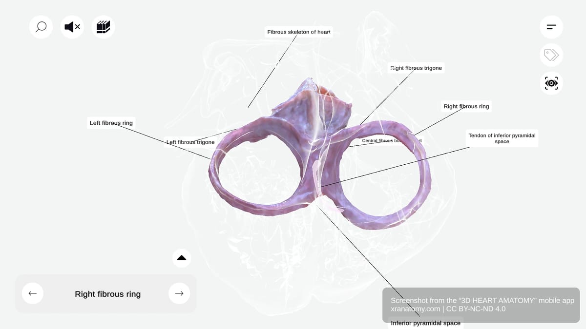 Fibrous rings of the heart showing right and left fibrous rings surrounding atrioventricular valve orifices