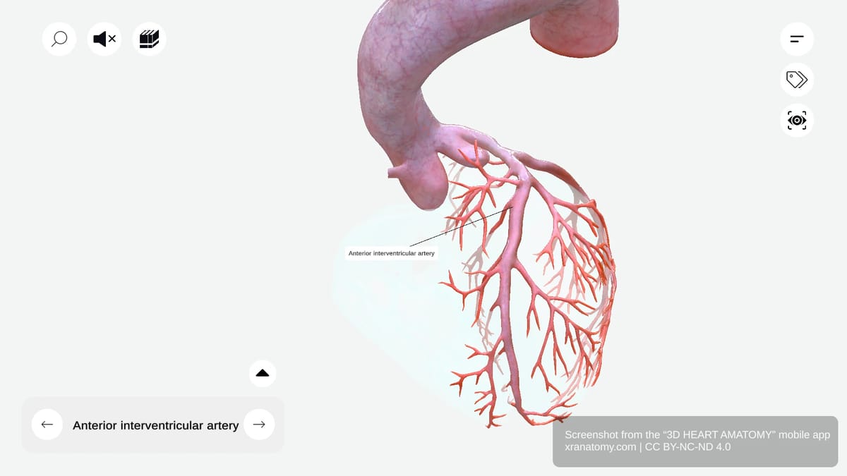 Anterior interventricular artery (left anterior descending) descending along interventricular sulcus with conal, diagonal, and septal branches