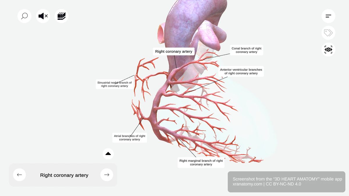 Branches of right coronary artery showing conal branch, SA nodal branch, atrial branches, anterior ventricular branches, and right marginal branch