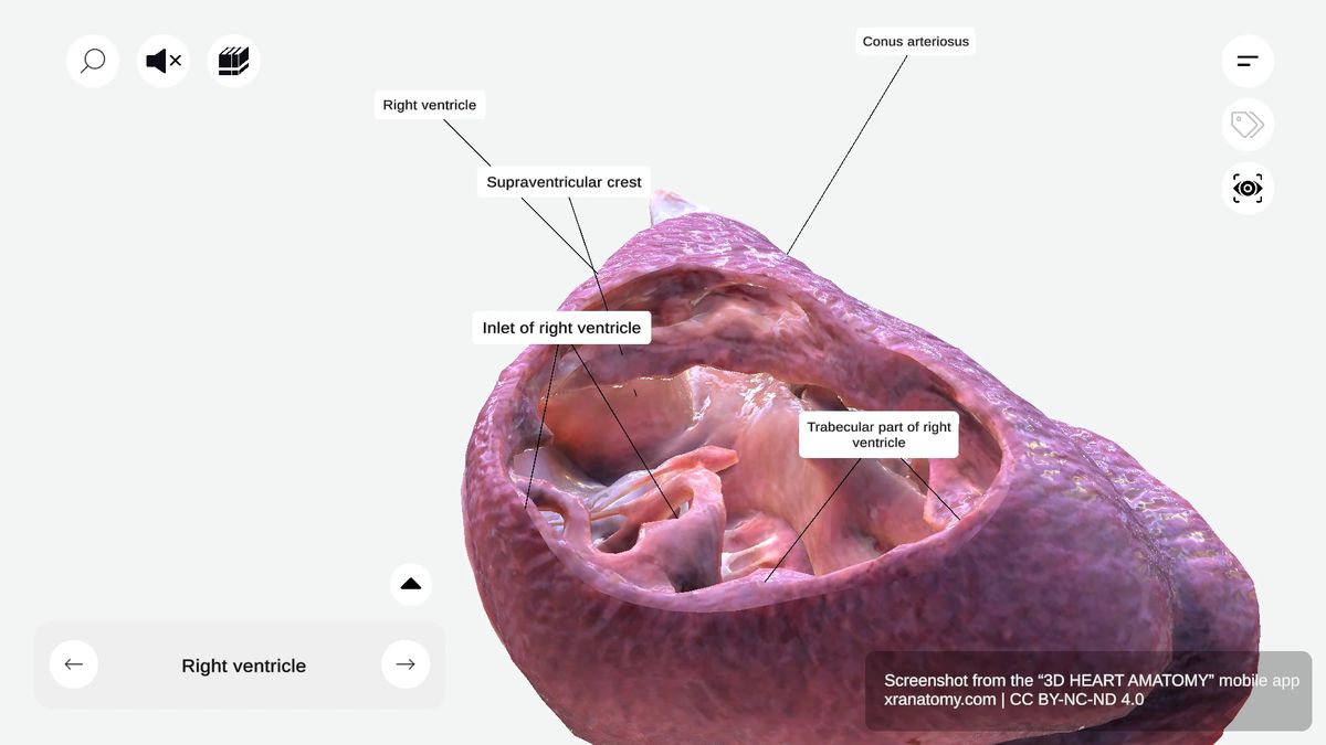 Outlet of right ventricle showing conus arteriosus (infundibulum) and pulmonary valve