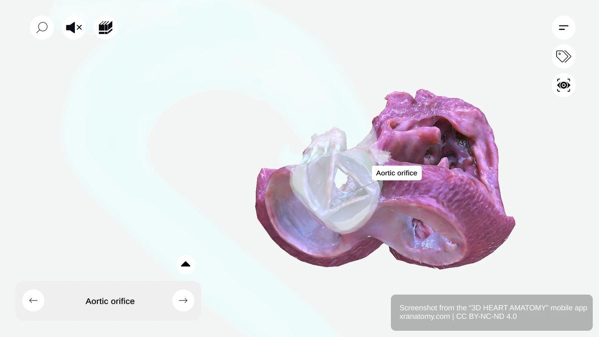 Aortic orifice showing the opening through which blood exits left ventricle, guarded by three aortic valve leaflets
