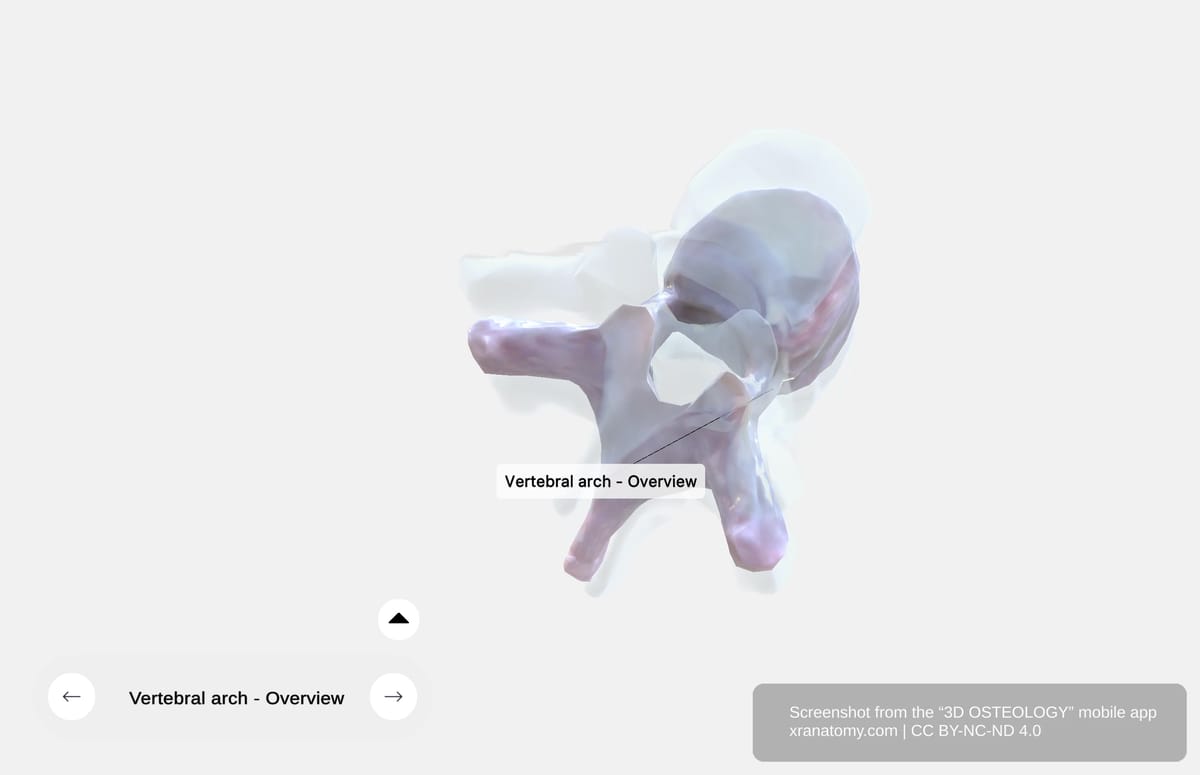 Vertebral arch anatomy showing pedicles connecting vertebral body to laminae, with spinous and transverse processes extending from the arch